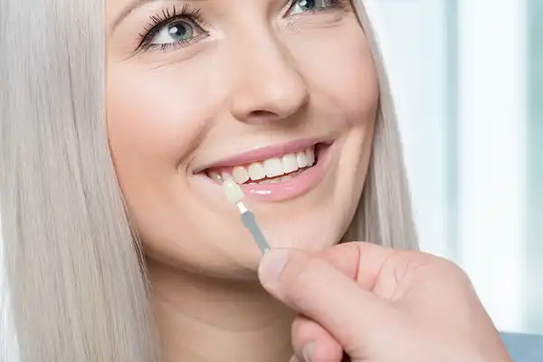 Dentist using a shade guide at womans mouth to check veneer