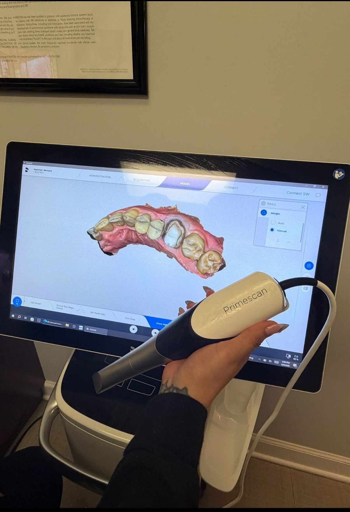Primescan intraoral scanner with a 3D model of teeth displayed on the monitor.